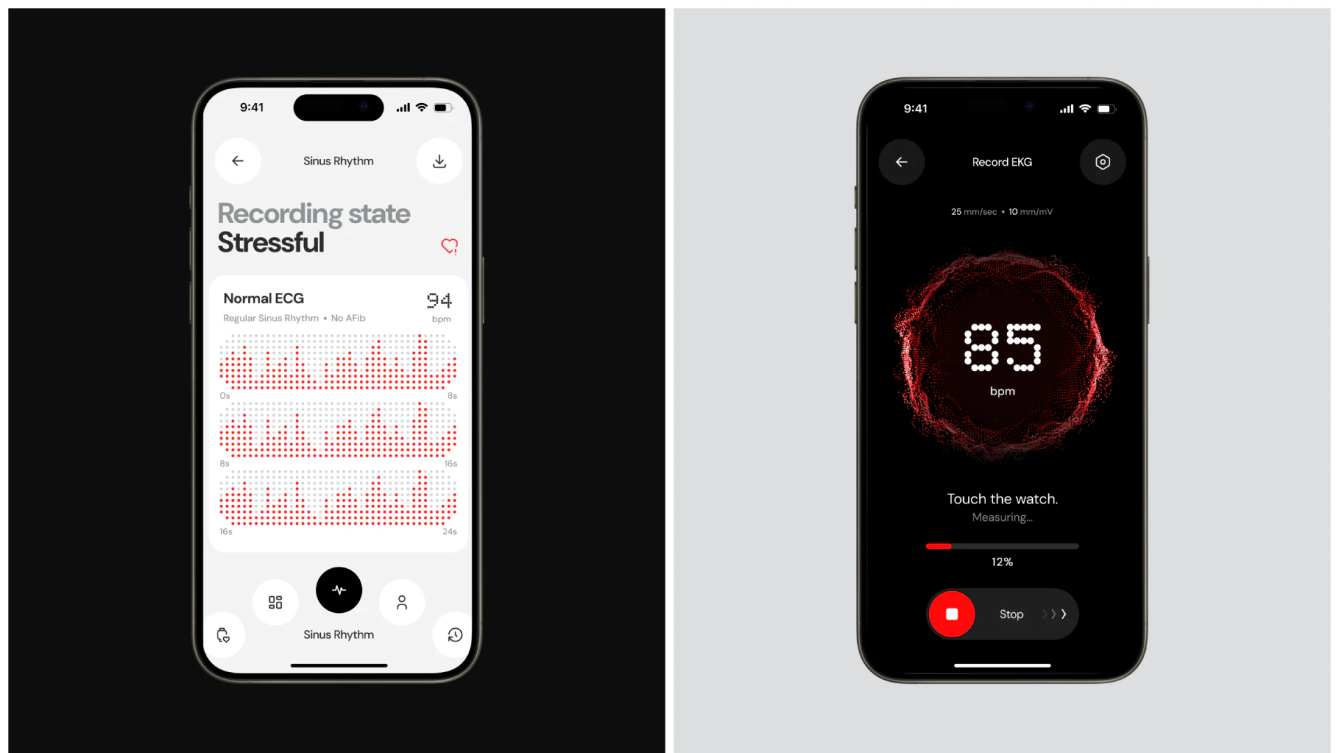 Black measurement state beside a white ECG record page